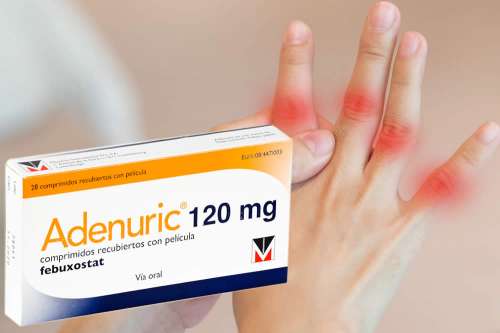 Recensione del Farmaco Adenuric 80mg e 120mg Compresse: Quando Fa bene? Quando Fa Male? Per Cosa si Usa? Dosi e Uso Corretto del Febuxostat contro Gotta e Iperuricemia. Foglio Illustrativo, Controindicazioni ed Effetti Collaterali