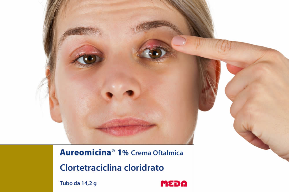 Aureomicina Crema Oftalmica