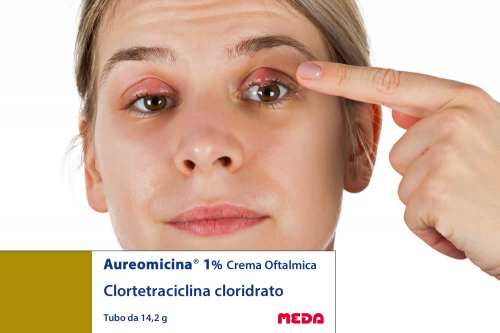 Recensione del Farmaco Aureomicina Crema Oftalmica: A Cosa Serve? Quando Fa bene? Quando Fa Male? Per Cosa si Usa? Dosi e Uso Corretto della clortetraciclina cloridrato come Antibiotico. Uso in Gravidanza, Foglio Illustrativo Spiegato, Controindicazioni