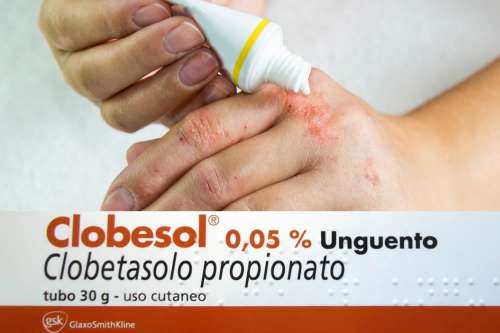 Recensione del Farmaco Clobesol Crema e Unguento: A Cosa Serve? Quando Fa bene? Quando Fa Male? Per Cosa si Usa? Dosi e Uso Corretto del clobetasolo contro Dermatiti, Psoriasi, Eczemi. Foglio Illustrativo Spiegato, Controindicazioni, Effetti Collaterali