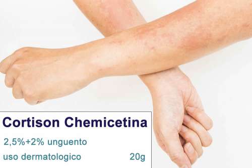 Recensione del Farmaco Cortison Chemicetina: Quando Fa bene? Quando Fa Male? Per Cosa si Usa? Dosi e Uso Corretto di idrocortisone acetato e cloramfenicolo nelle infezioni topiche e oftalmiche. Foglio Illustrativo Spiegato ed Effetti Collaterali