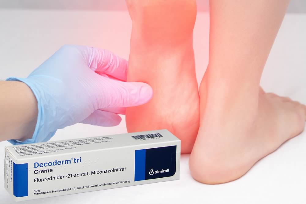 Decoderm