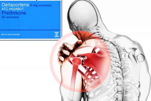 Recensione del Farmaco Deltacortene 25mg e Deltacortene 5mg: A Cosa Serve? Quando Fa bene? Quando Fa Male? Per Cosa si Usa? Dosi e Uso Corretto del Prednisone. Foglio Illustrativo Spiegato, Controindicazioni, Prezzo ed Effetti Collaterali