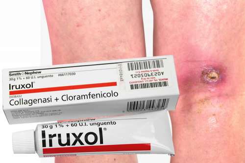 Recensione del Farmaco Iruxol Pomata (Iruxol Unguento): A Cosa Serve? Quando Fa bene? Quando Fa Male? Per Cosa si Usa? Dosi e Uso Corretto per la Disinfezione e la Cicatrizzazione delle Ferite. Foglio Illustrativo, Effetti Collaterali e Controindicazioni