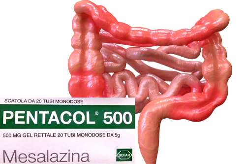 Recensione del Farmaco Pentacol Compresse, Schiuma, Gel e Supposte: A Cosa Serve? Quando Fa bene? Quando Fa Male? Per Cosa si Usa? Dosi e Uso Corretto contro la Colite Ulcerosa. Foglio Illustrativo Spiegato, Controindicazioni, Effetti Collaterali