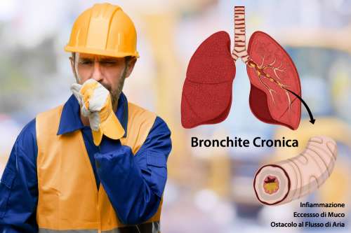 In questo articolo parliamo della Bronchite Cronica, delle sue Cause e dei Sintomi Associati. E' un Disturbo Grave? Quando Consultare il medico? Informazioni sulle Cure, i Farmaci e i Rimedi Efficaci per la Cura della Bronchite Cronica