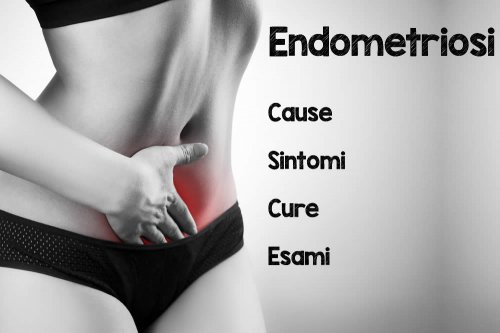 In questo articolo parliamo dell'Endometriosi, delle sue Cause e dei Sintomi Associati. E' un Disturbo Grave? Quando Consultare il medico? Quali Esami per la Diagnosi? Informazioni sulle Cure e i Rimedi Efficaci per la Cura dell'Endometriosi