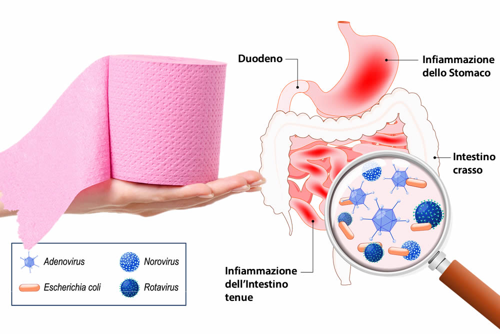 Gastroenterite