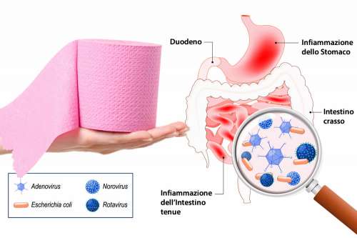 In questo articolo parliamo di Gastroenterite, delle sue Cause e dei Sintomi Associati. E' un Disturbo Grave? Quando Consultare il medico? Esami per la Diagnosi, Informazioni sulle Cure, la Dieta e i Rimedi Efficaci per la Cura dell'Influenza Intestinale